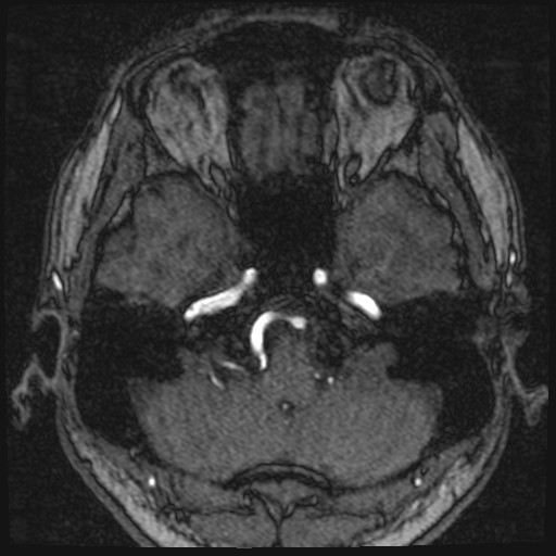 Click on the Serie image to view the images of VILLANUEVA, WILLIAM A.